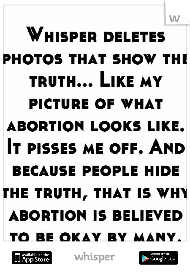 Whisper deletes photos that show the truth... Like my picture of what abortion looks like. It pisses me off. And because people hide the truth, that is why abortion is believed to be okay by many.