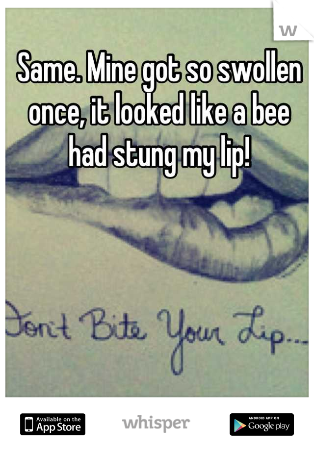 Same. Mine got so swollen once, it looked like a bee had stung my lip!