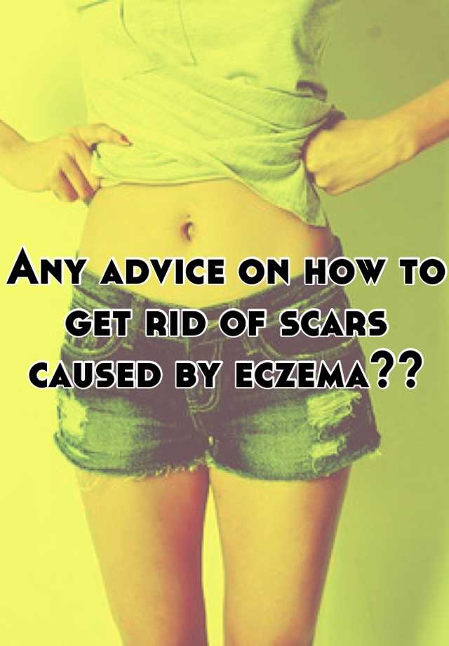 any-advice-on-how-to-get-rid-of-scars-caused-by-eczema