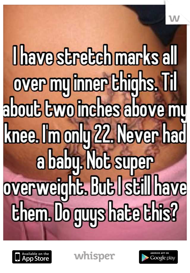 I have stretch marks all over my inner thighs. Til about ...