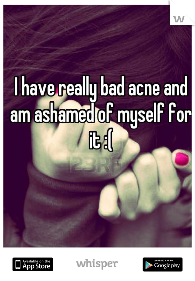 I have really bad acne and am ashamed of myself for it :(