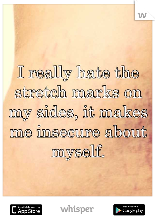 I really hate the stretch marks on my sides, it makes me insecure about myself.