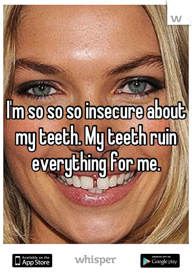 I'm so so so insecure about my teeth. My teeth ruin everything for me.