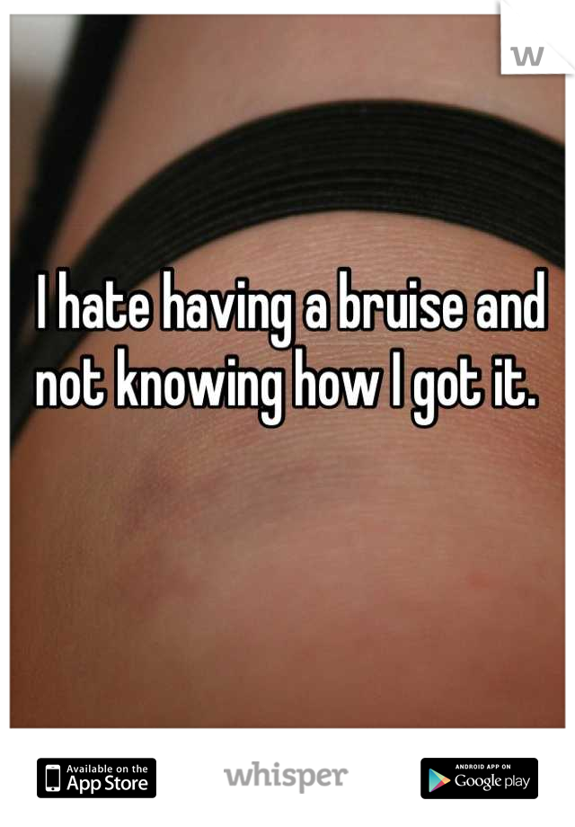 I hate having a bruise and not knowing how I got it. 