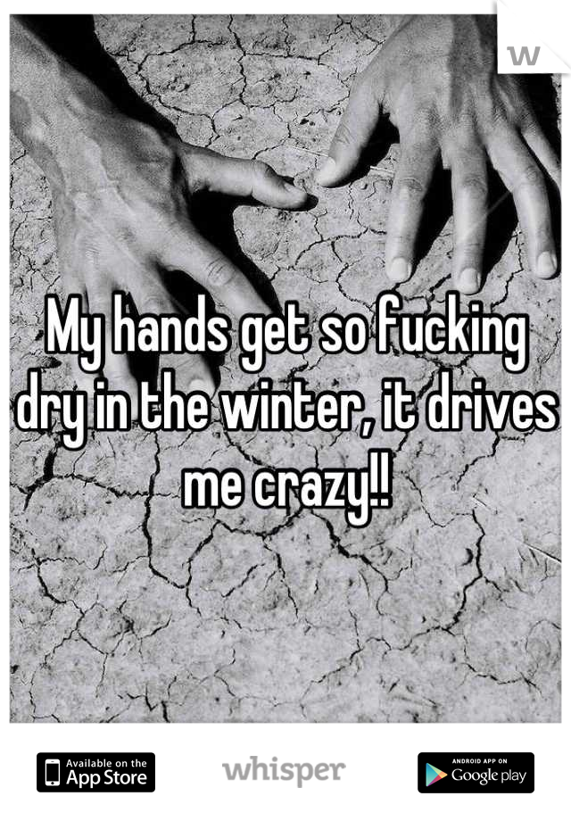 My hands get so fucking dry in the winter, it drives me crazy!!