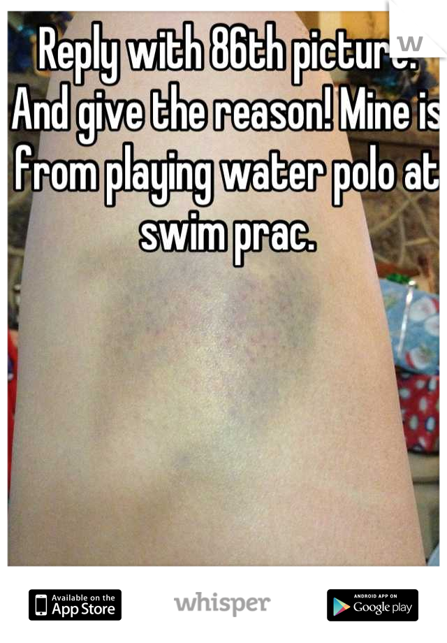 Reply with 86th picture. And give the reason! Mine is from playing water polo at swim prac.