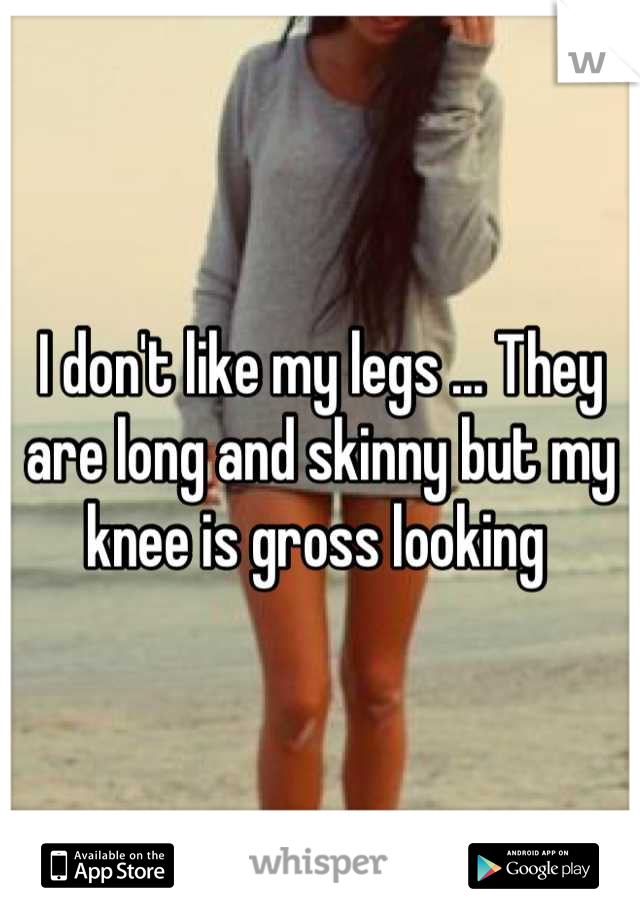 I don't like my legs ... They are long and skinny but my knee is gross looking 