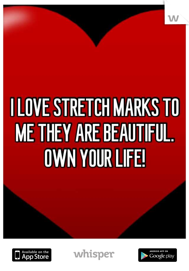 I LOVE STRETCH MARKS TO ME THEY ARE BEAUTIFUL. OWN YOUR LIFE!