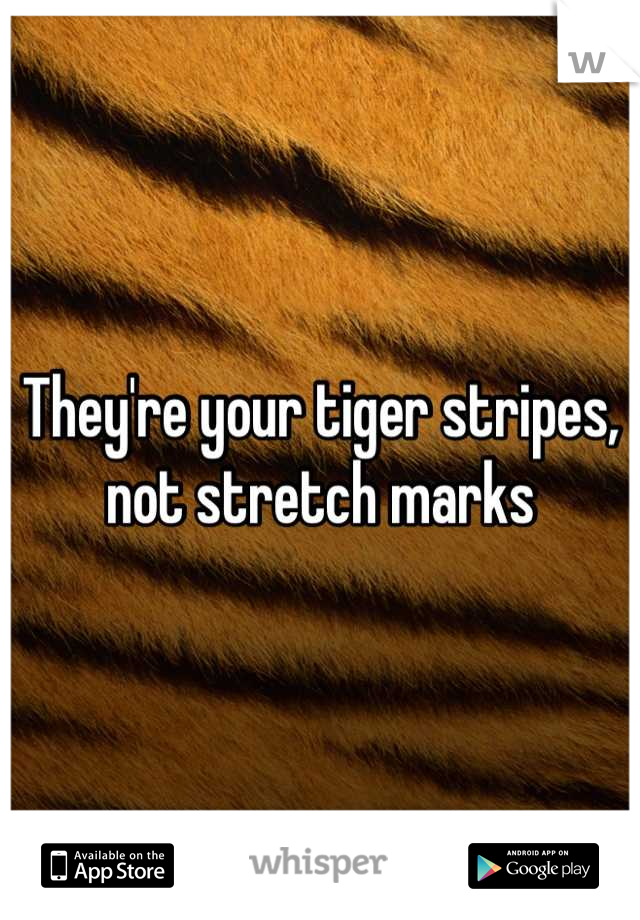 They're your tiger stripes, not stretch marks