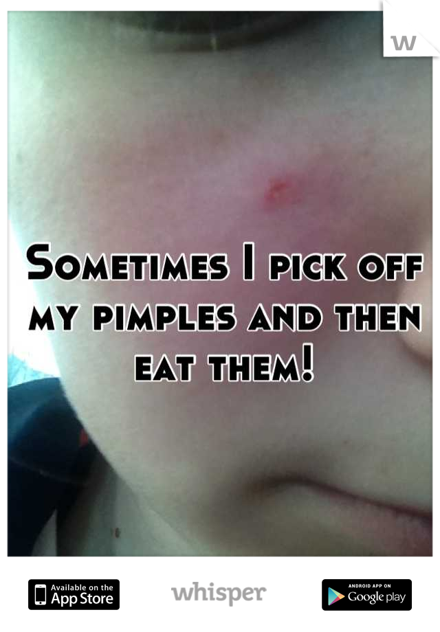 Sometimes I pick off my pimples and then eat them!