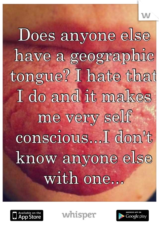 Does anyone else have a geographic tongue? I hate that I do and it makes me very self conscious...I don't know anyone else with one...