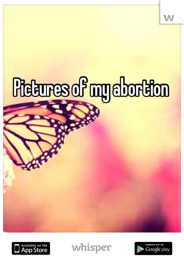 Pictures of my abortion 