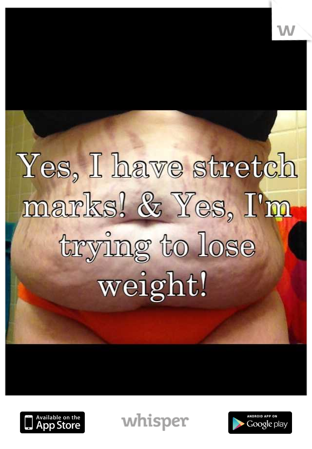 Yes, I have stretch marks! & Yes, I'm trying to lose weight! 