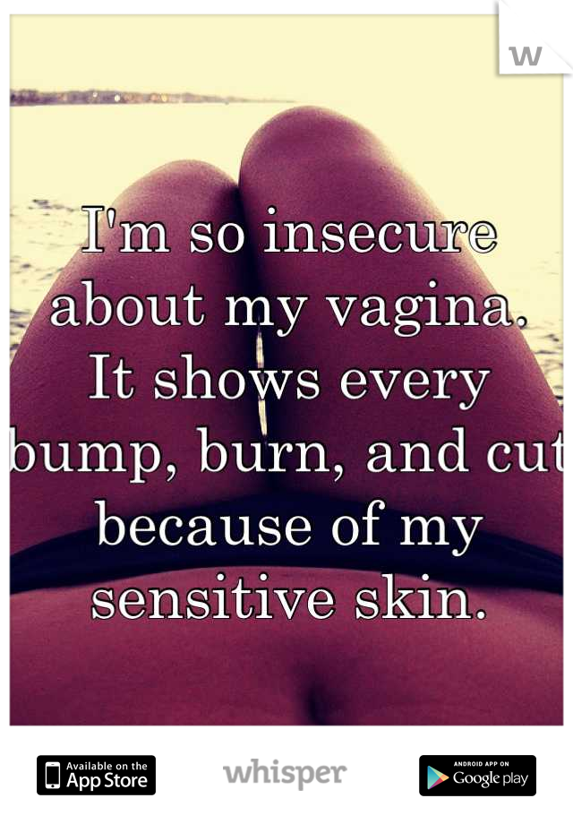 I'm so insecure about my vagina.
It shows every bump, burn, and cut because of my sensitive skin.
