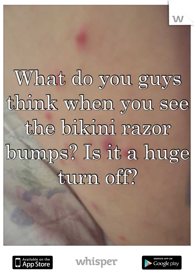What do you guys think when you see the bikini razor bumps? Is it a huge turn off?