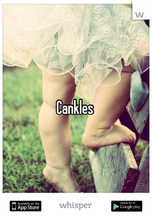 Cankles 
