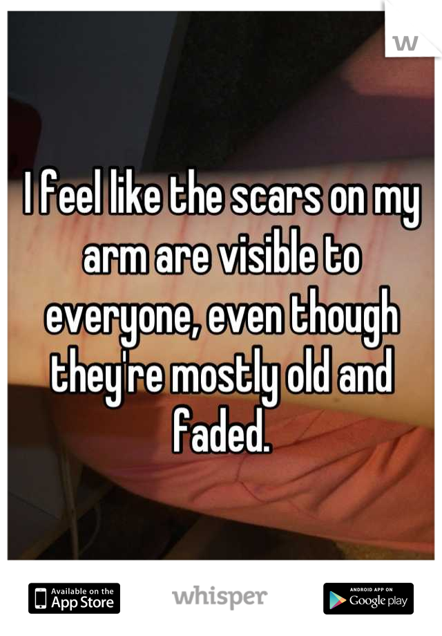I feel like the scars on my arm are visible to everyone, even though they're mostly old and faded.