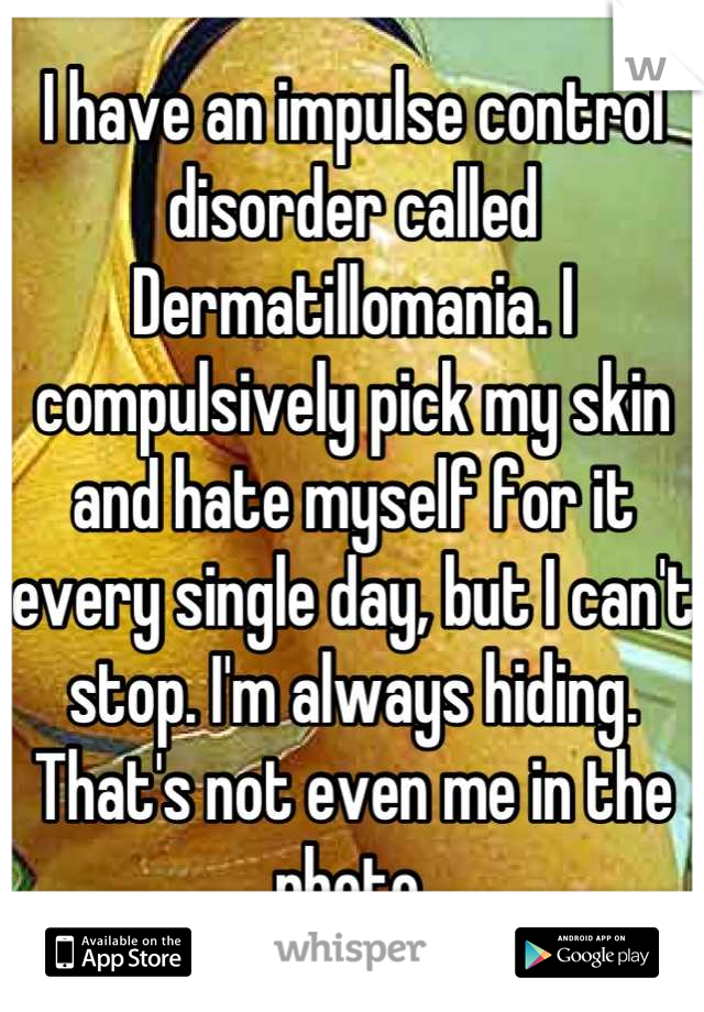 I have an impulse control disorder called Dermatillomania. I compulsively pick my skin and hate myself for it every single day, but I can't stop. I'm always hiding. That's not even me in the photo.