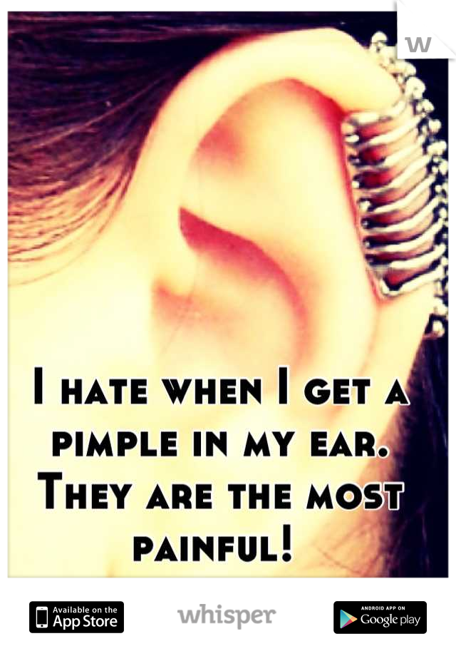 I hate when I get a pimple in my ear. They are the most painful! 