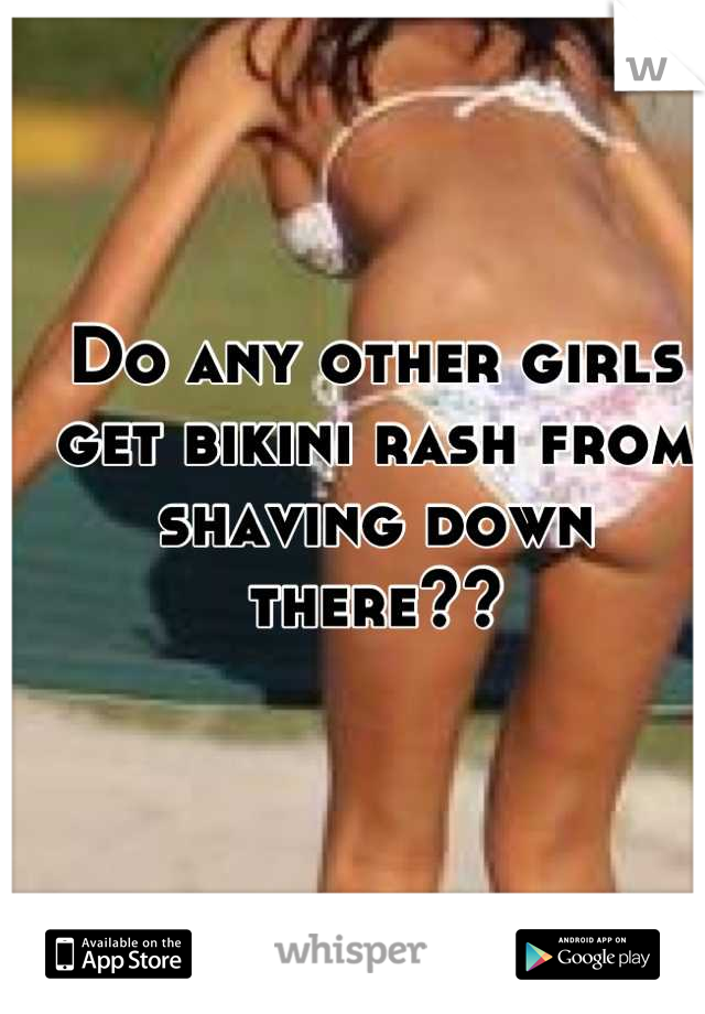 Do any other girls get bikini rash from shaving down there??