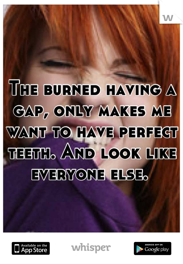 The burned having a gap, only makes me want to have perfect teeth. And look like everyone else. 