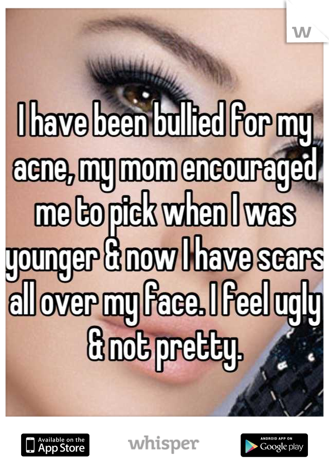 I have been bullied for my acne, my mom encouraged me to pick when I was younger & now I have scars all over my face. I feel ugly & not pretty.
