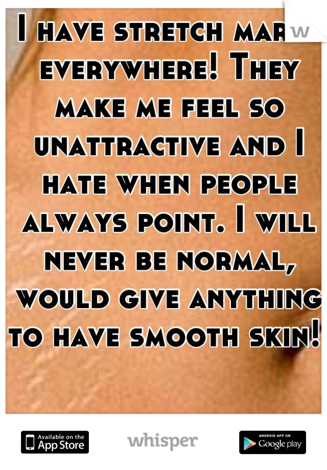 I have stretch marks everywhere! They make me feel so unattractive and I hate when people always point. I will never be normal, would give anything to have smooth skin! 