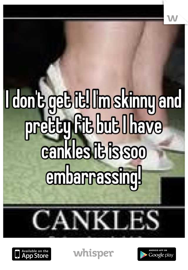 I don't get it! I'm skinny and pretty fit but I have cankles it is soo embarrassing!