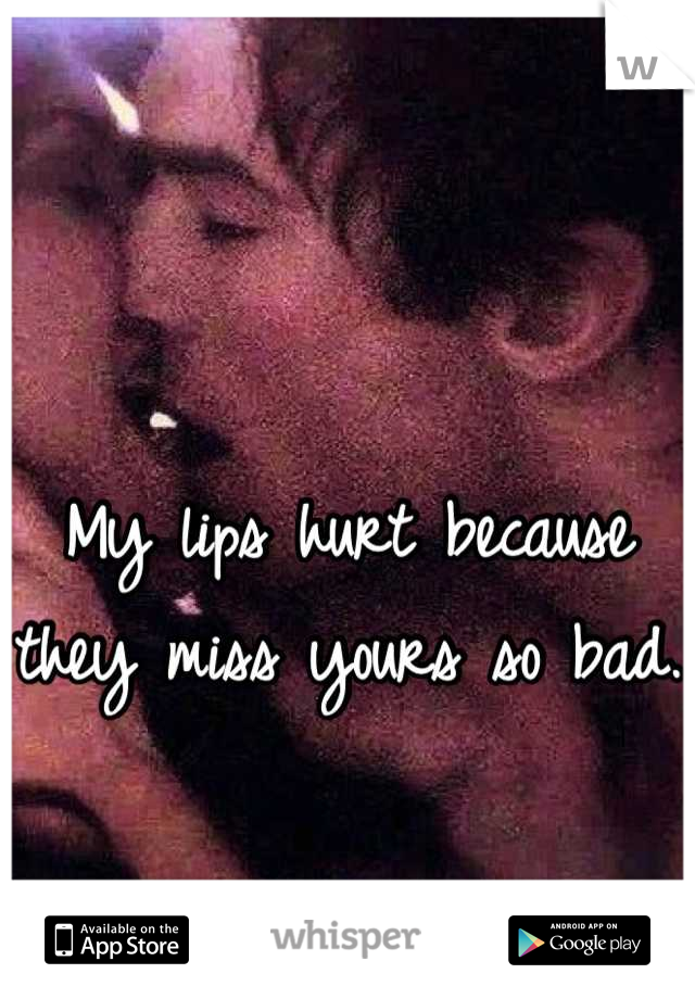 My lips hurt because they miss yours so bad.