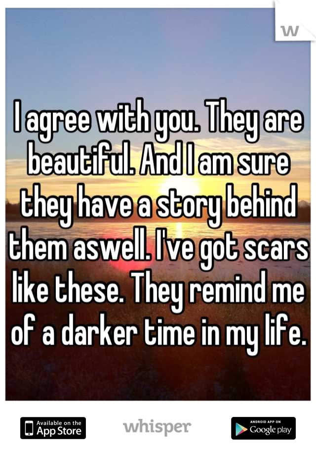 I agree with you. They are beautiful. And I am sure they have a story behind them aswell. I've got scars like these. They remind me of a darker time in my life.