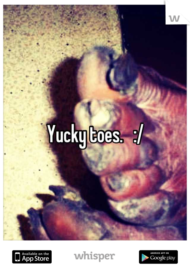 Yucky toes.   :/
