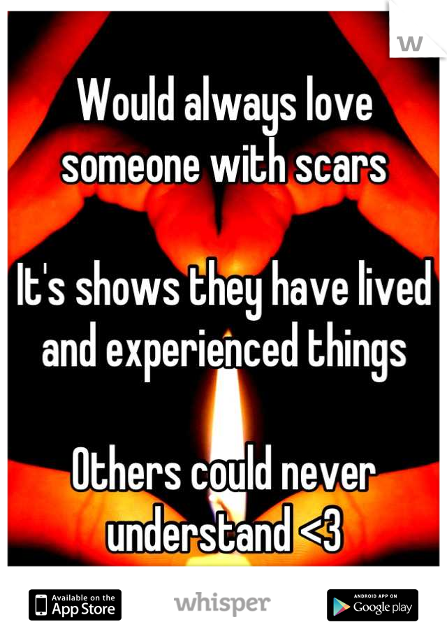Would always love someone with scars 

It's shows they have lived and experienced things

Others could never understand <3