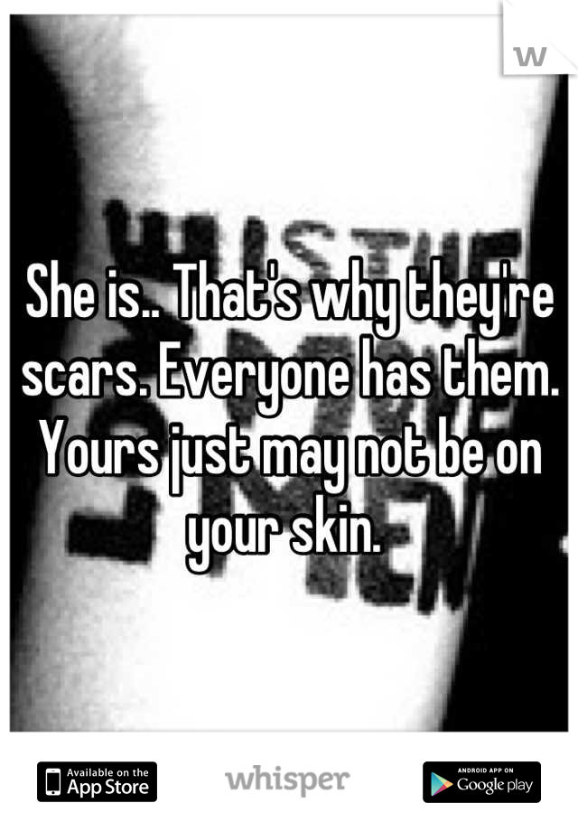 She is.. That's why they're scars. Everyone has them. Yours just may not be on your skin. 
