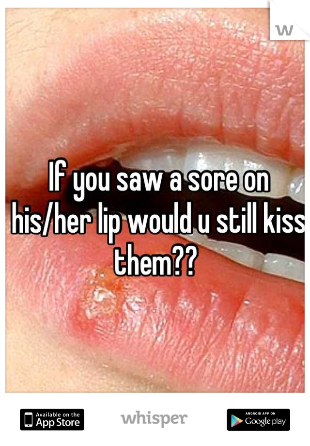 If you saw a sore on his/her lip would u still kiss them?? 