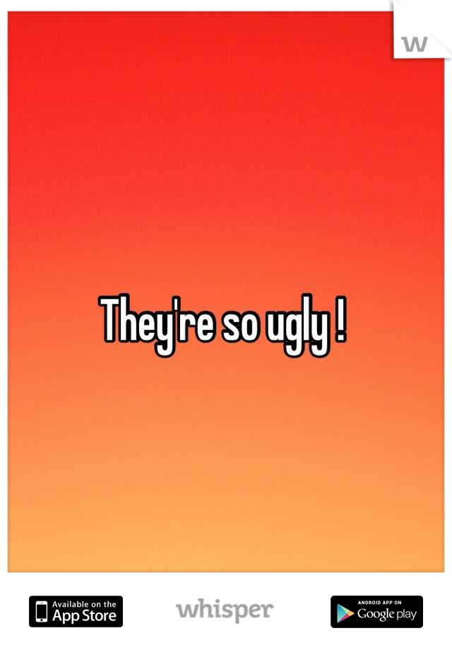 They're so ugly ! 