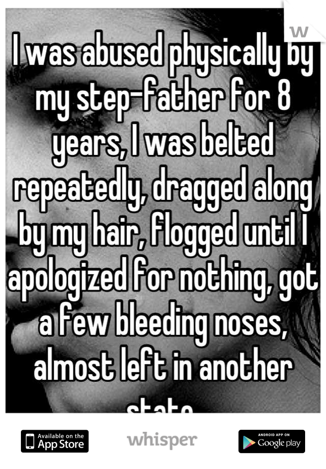 I was abused physically by my step-father for 8 years, I was belted repeatedly, dragged along by my hair, flogged until I apologized for nothing, got a few bleeding noses, almost left in another state 