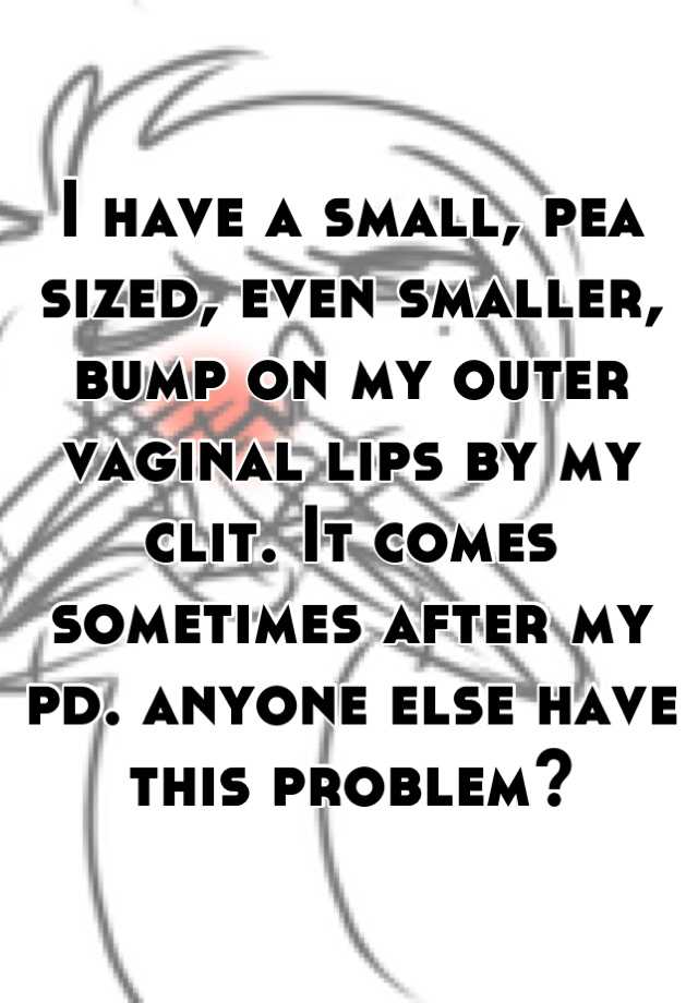 I Have A Small Pea Sized Even Smaller Bump On My Outer Vaginal Lips By My Clit It Comes 4362