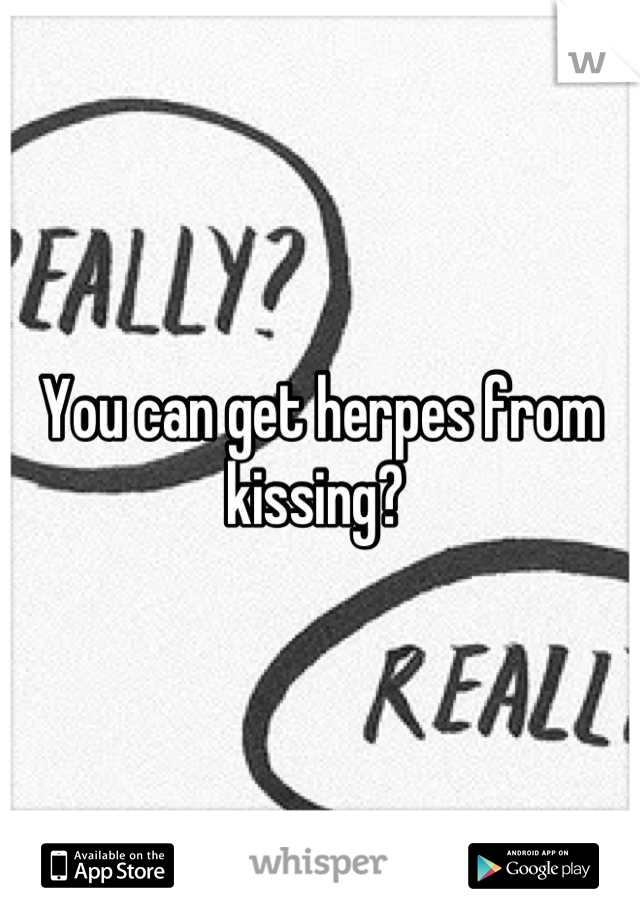 You can get herpes from kissing? 