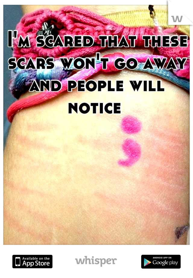 I'm scared that these scars won't go away and people will notice 
