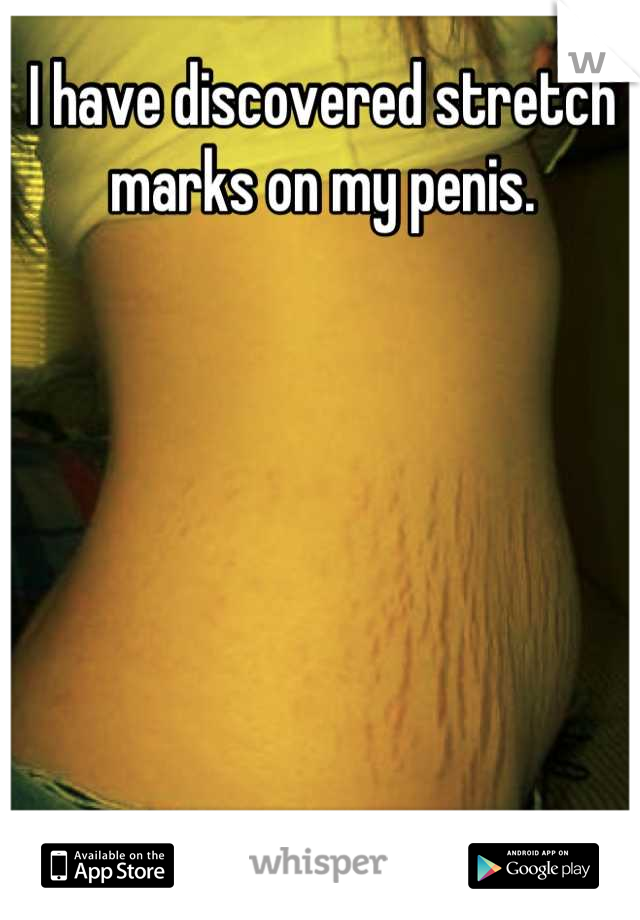 I have discovered stretch marks on my penis.