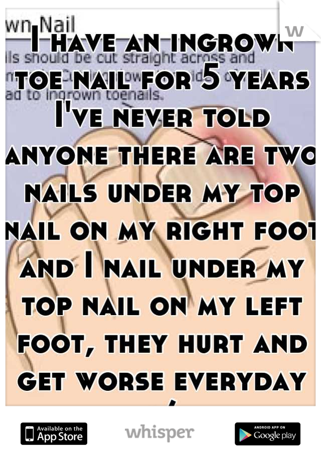 I have an ingrown toe nail for 5 years I've never told anyone there are two nails under my top nail on my right foot and I nail under my top nail on my left foot, they hurt and get worse everyday :/