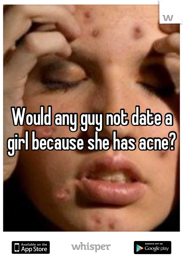 Would any guy not date a girl because she has acne?