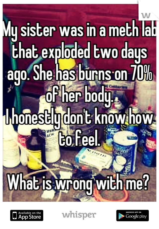 My sister was in a meth lab that exploded two days ago. She has burns on 70% of her body. 
I honestly don't know how to feel.

What is wrong with me? 