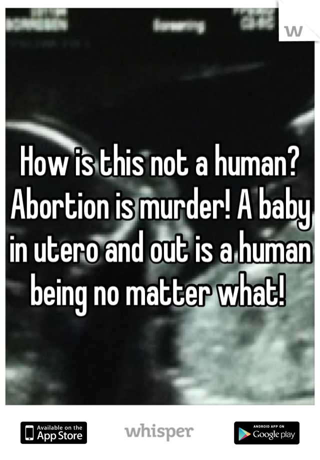 How is this not a human? Abortion is murder! A baby in utero and out is a human being no matter what! 