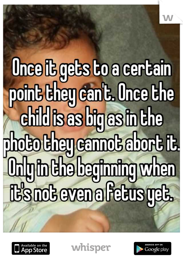 Once it gets to a certain point they can't. Once the child is as big as in the photo they cannot abort it. Only in the beginning when it's not even a fetus yet.