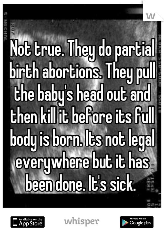 Not true. They do partial birth abortions. They pull the baby's head out and then kill it before its full body is born. Its not legal everywhere but it has been done. It's sick. 