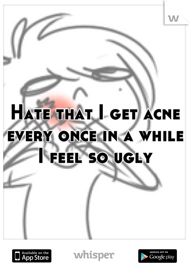 Hate that I get acne every once in a while
I feel so ugly