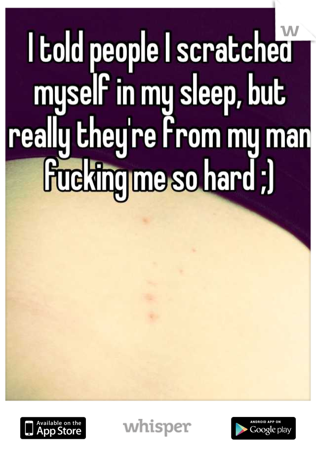 I told people I scratched myself in my sleep, but really they're from my man fucking me so hard ;)