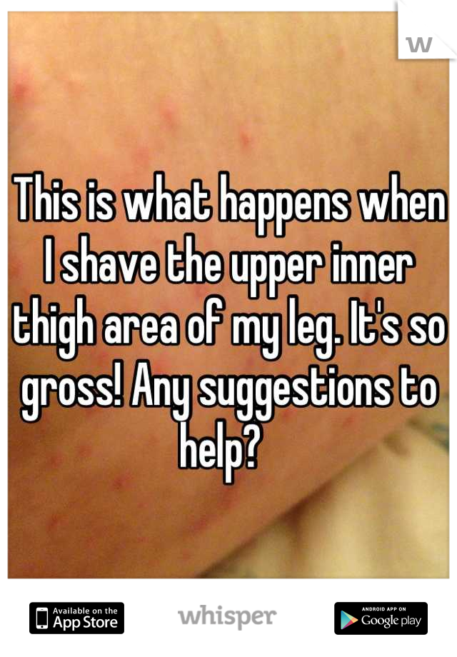 This is what happens when I shave the upper inner thigh area of my leg. It's so gross! Any suggestions to help?  