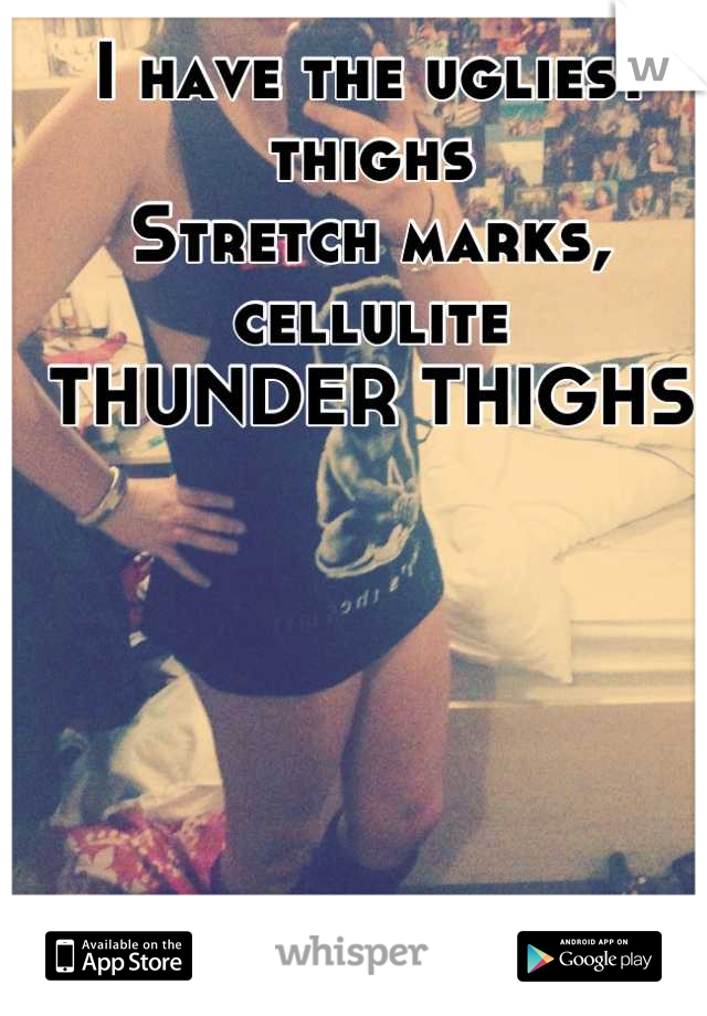 I have the ugliest thighs
Stretch marks, cellulite
THUNDER THIGHS